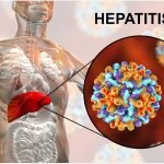 HEPATITIS B HEPATITIS B
